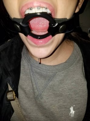 amateur pic Gagged brace face