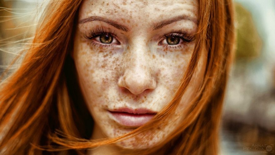 Freckles, freckles and more freckles.