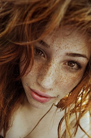 Freckles