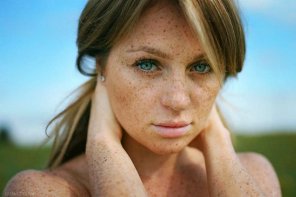 Freckled and beautiful