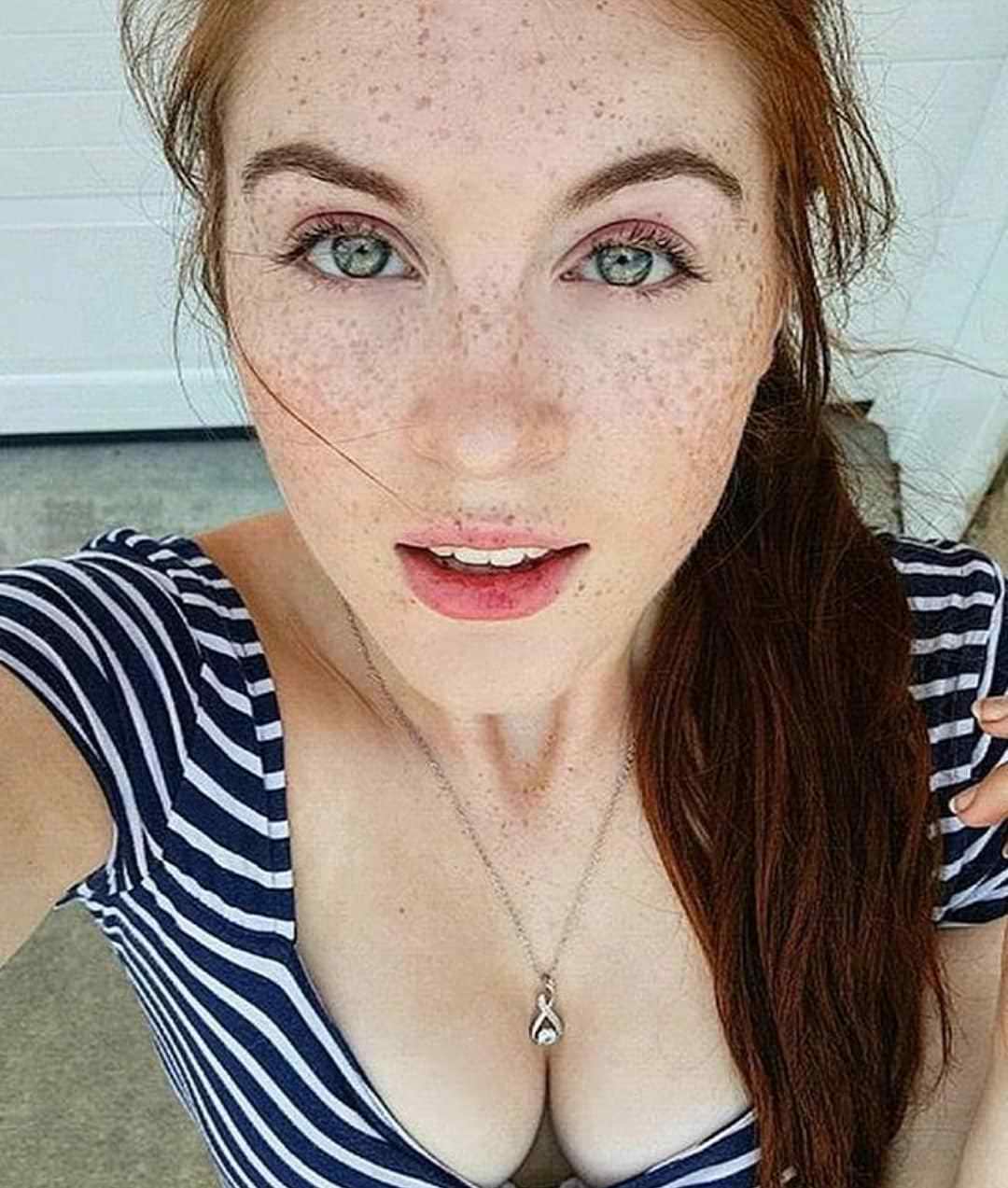 Teen Freckles