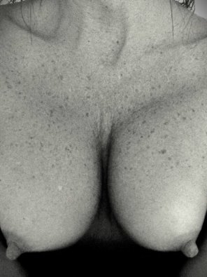 Freckled chest