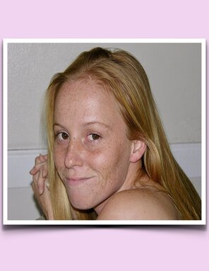 ‎Pretty Young Freckles.‎38
