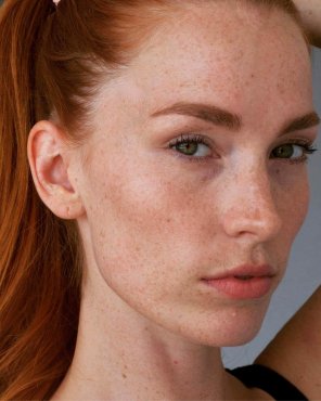 Healthy dose of redhead and freckles.
