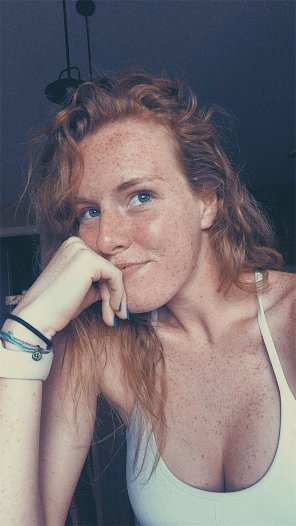 amateur pic Endless Freckles