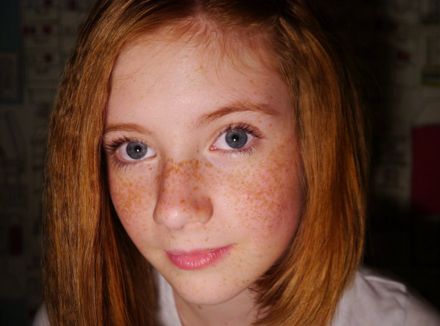 Natural freckles shared drunk